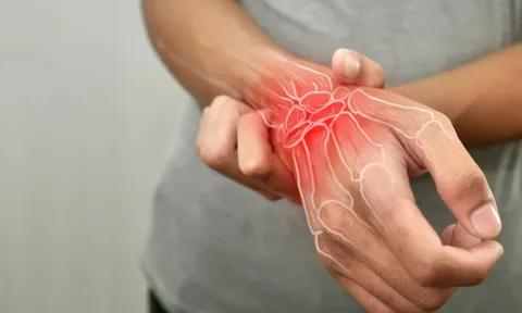 Hợp chất tự nhiên mở hướng tiếp cận mới trong điều trị viêm khớp dạng thấp