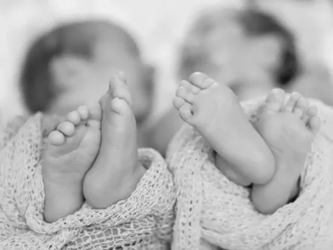 Cặp sinh đôi khác cha khiến mẹ ruột cũng choáng váng