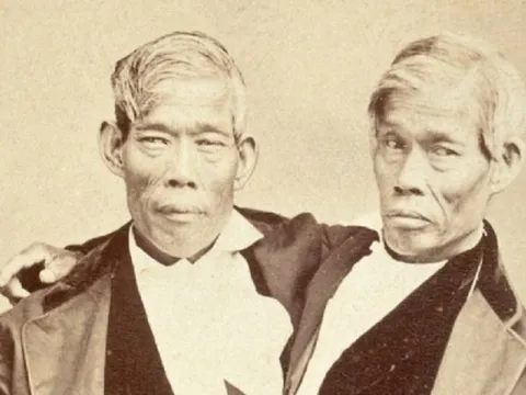 Bí ẩn 2 anh em song sinh dính liền lấy 2 chị em, sinh được 21 người con và có 1.500 hậu duệ