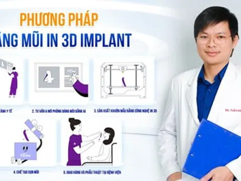 Bác sĩ Nguyễn Tuấn Anh cùng ứng dụng công nghệ Nâng Mũi In 3D Implant