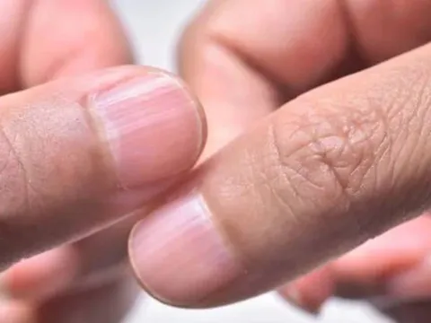 Bàn tay không có 5 đặc điểm này chứng tỏ gan khỏe mạnh, sống thọ