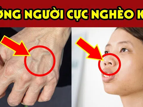 Người phúc mỏng, phận bạc trên bàn tay thường có điểm này: Ai không có thật đáng chúc mừng