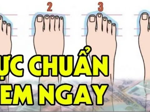 Người giàu có trên bàn chân có dấu hiệu này: Ai sở hữu không thành tỷ phú cũng thành đại gia