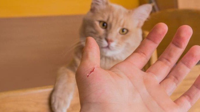 Dù mèo cắn không bị chảy máu, bạn vẫn nên tìm đến các cơ sở y tế để được tư vấn 