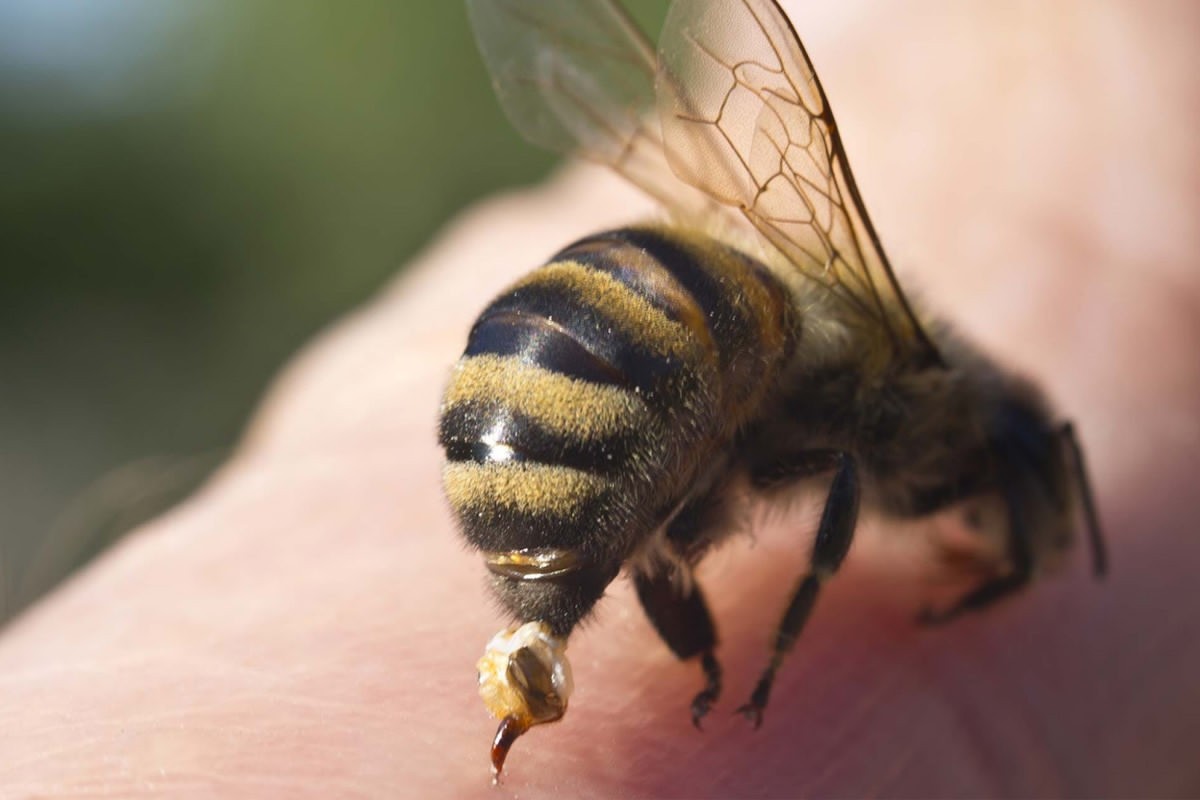 Ong đốt có thể gây nên ảnh hưởng đến sức khỏe, thậm chí là tính mạng của con người