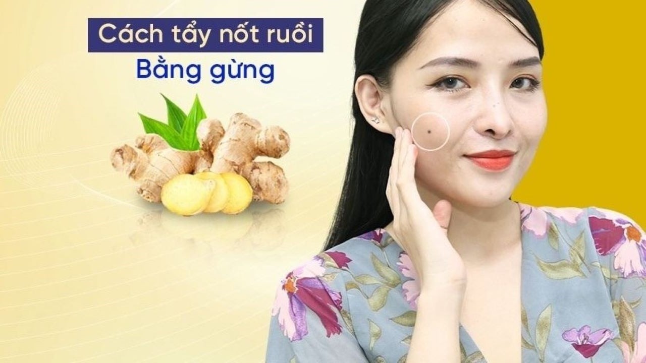 Cách tẩy nốt ruồi bằng gừng tươi. (Ảnh minh họa)