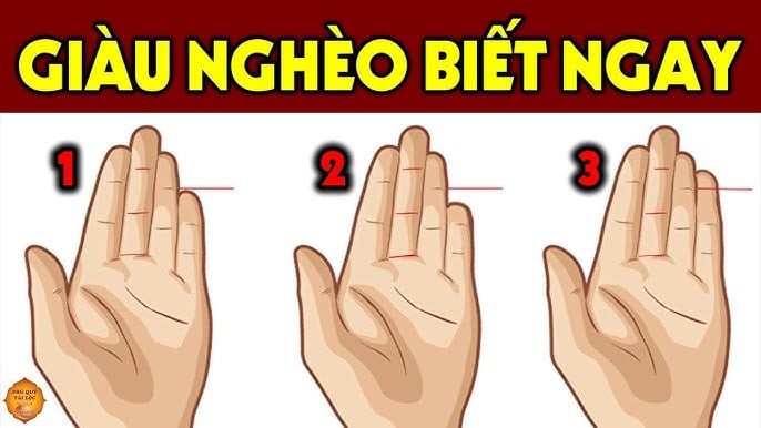 Người nghèo trên bàn tay có tướng này