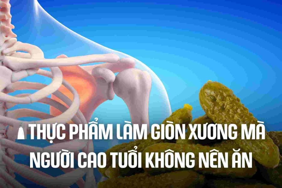 3 loại nước là 'vua rút cạn canxi, uống nhiều xương giòn, dễ gãy