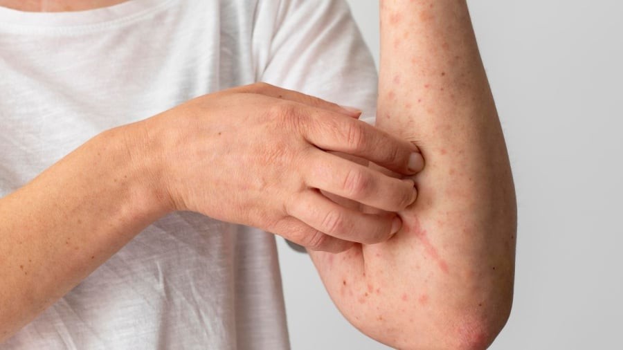 Cảnh báo dấu hiệu bệnh thận