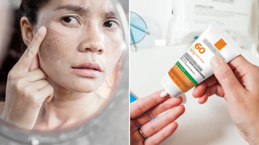 Thoa kem chống nắng không đủ là một trong những sai lầm khiến nhiều người gặp phải khiến da không được bảo vệ trước ánh sáng mặt trời.