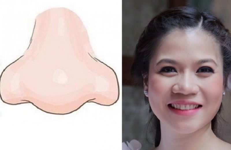 Phụ nữ mũi to xấu xí nhưng lại vô cùng nhiều phúc lộc