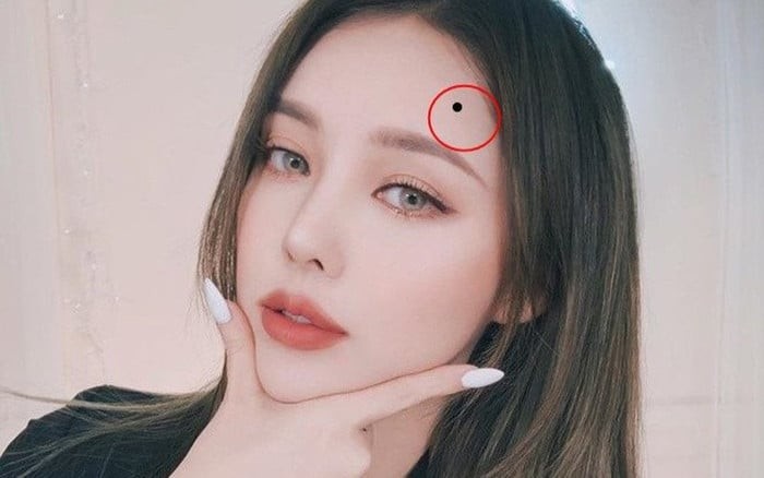 Nốt ruồi may mắn