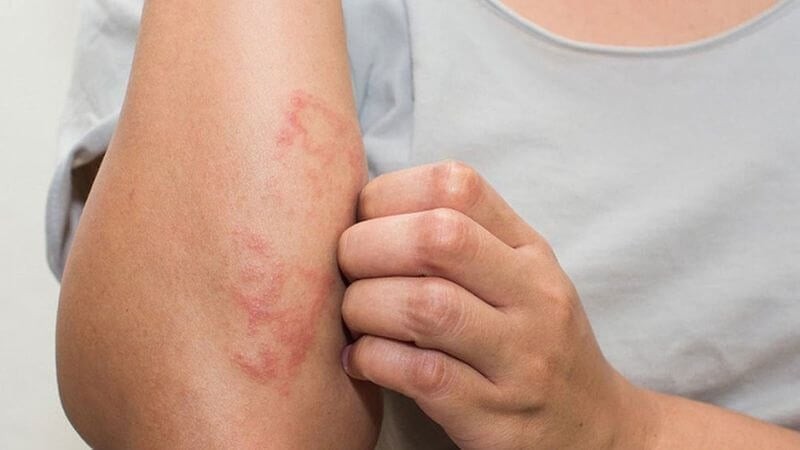 Cảnh báo dấu hiệu bệnh thận sớm