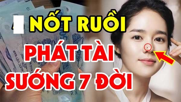 3 nốt ruồi phá tướng 