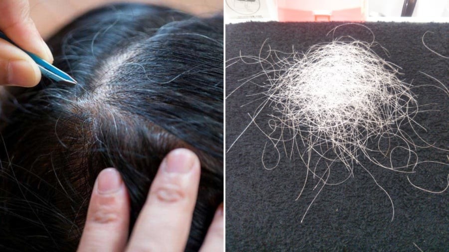 Thường xuyên nhổ tóc bạc có thể gây ra nhiều tác hại hơn bạn nghĩ.