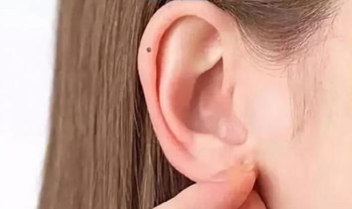 Phụ nữ có nốt ruồi trên tai phải