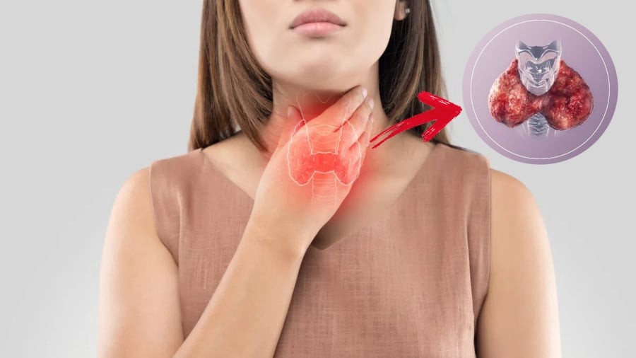 Ung thư tuyến giáp là một bệnh không hiếm gặp.