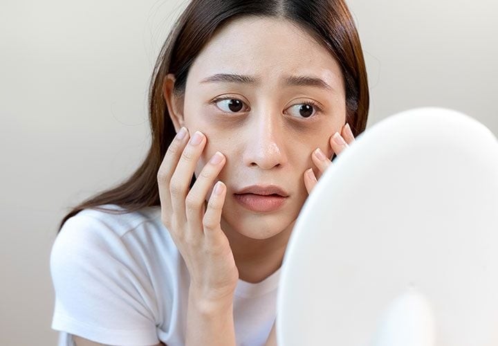 Đừng chủ quan nếu sưng mặt sưng mí mắt vào buổi sáng