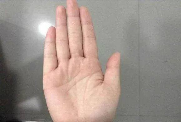 Lòng bàn tay dày, có độ đàn hồi tốt

