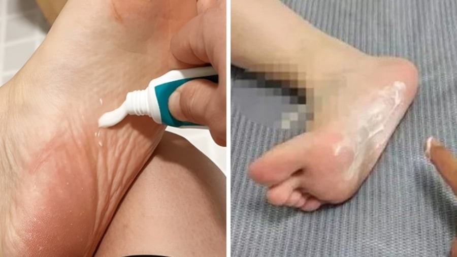 Thực hiện đều đặn mỗi tối trước khi ngủ trong khoảng 1–2 tuần, bạn sẽ cảm nhận rõ sự cải thiện về giấc ngủ, tâm trạng và cả đôi chân thư giãn hơn hẳn.