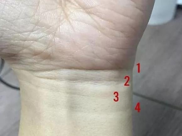 Người có 4 ngấn cổ tay