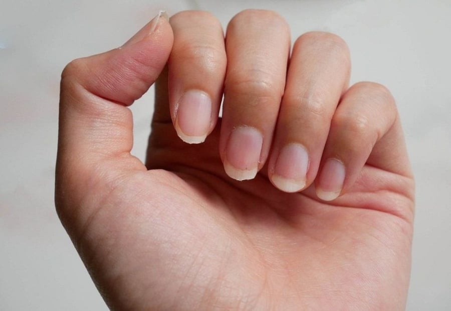 Nhìn móng tay bắt bệnh chính xác
