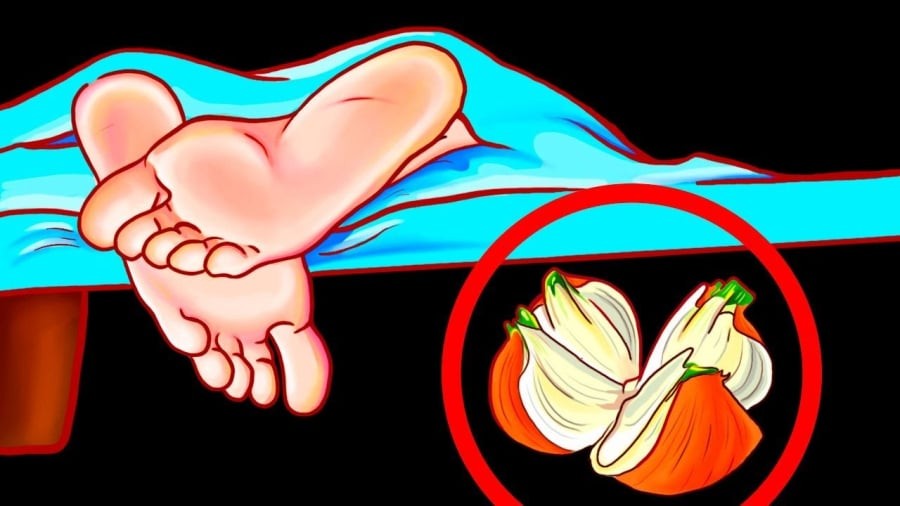 Đặt 1 củ hành tây ở đầu giường