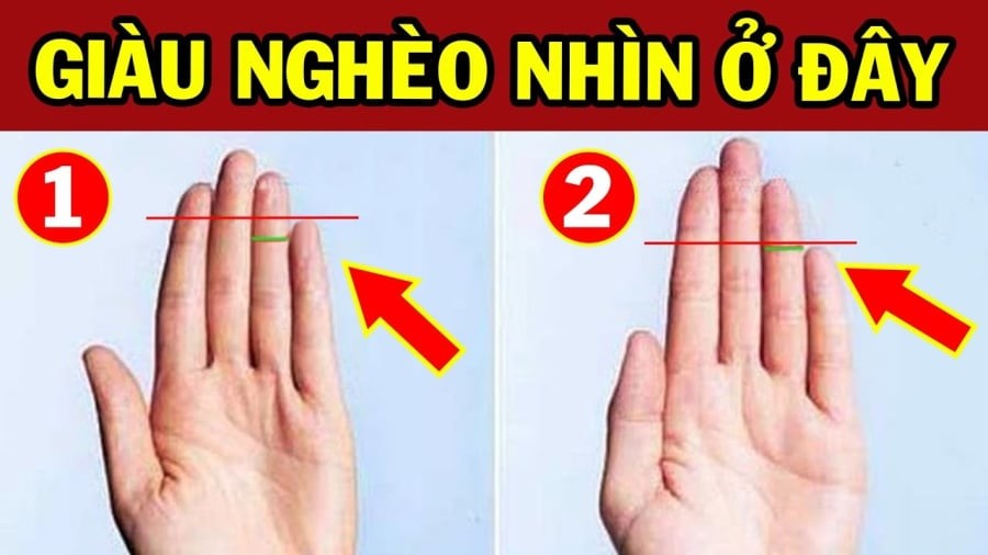 Xem độ dài ngón út, biết ngay ai nghèo hèn mạt kiếp, ai sinh ra