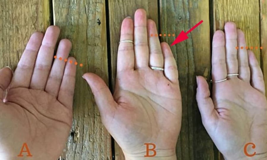 Xem độ dài ngón út, biết ngay ai nghèo hèn mạt kiếp, ai sinh ra