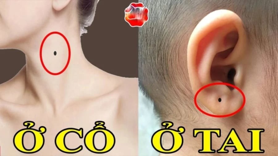 Dái tai dày và có nốt ruồi được xem là dấu hiệu của người có tướng phúc hậu, trường thọ và đặc biệt là hút tài hút lộc.