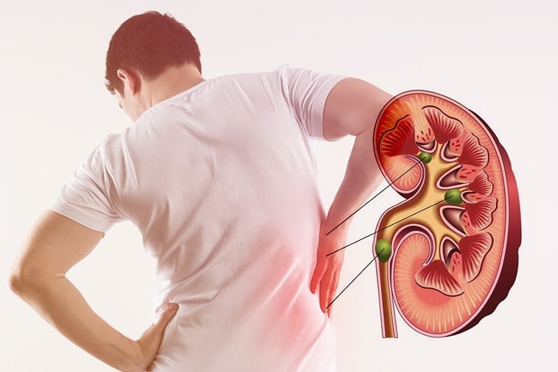 Cảnh báo dấu hiệu bạn đang bị suy thận
