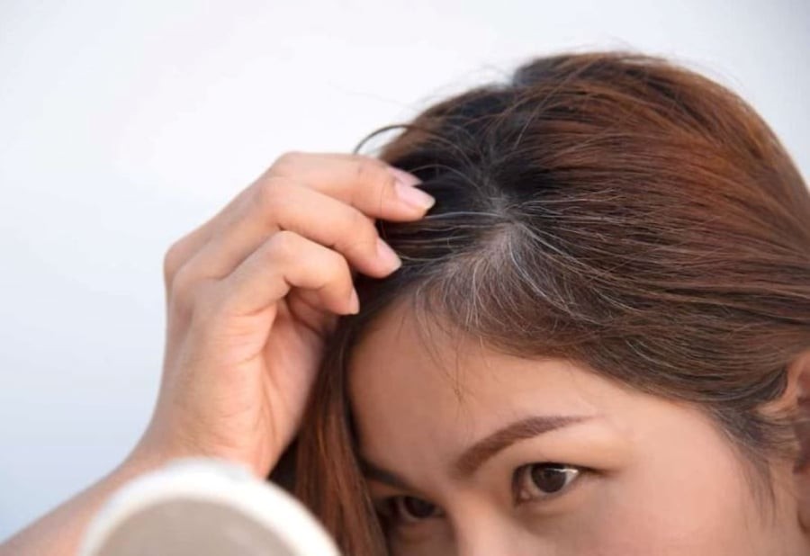 Tóc bạc sớm, ngoài lão hóa, một yếu tố khác mà nhiều người có xu hướng bỏ qua đó là tình trạng thiếu dinh dưỡng. (Ảnh minh họa)