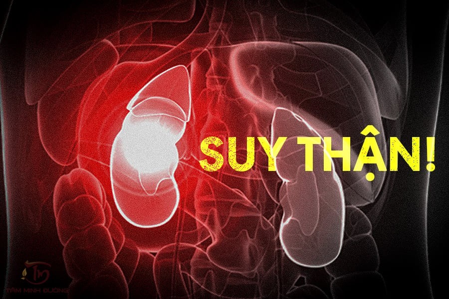 7 dấu hiệu cảnh báo suy thận giai đoạn sớm, ai chủ quan dễ bị nặng, chạy thận suốt đời