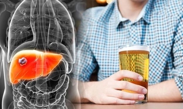 Uống cốc nước này tưởng lành mạnh nhưng đang phá nát gan, ngon mấy cũng đừng tiếc