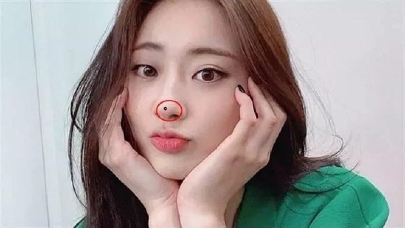 Nốt ruồi chặn tài lộc
