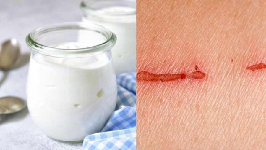 Các nhà khoa học đã sử dụng túi vi bào chiết xuất từ sữa chua để tạo ra loại gel tiêm vào cơ thể giúp phục hồi vết thương