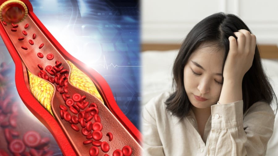 Duy trì các thói quen sống lành mạnh giúp làm sạch mạch máu, ngăn ngừa các mảng bám tích tụ ở thành mạch.