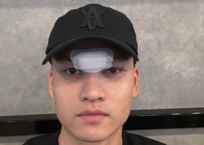 Việt Anh khâu 14 mũi sau pha va chạm ở trận đấu vừa qua.