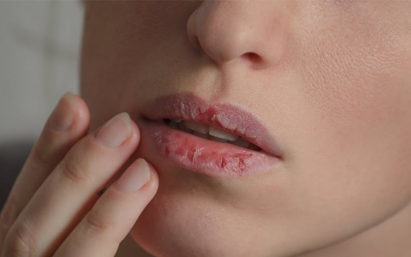 Môi dần trở nên khô ráp, xỉn màu, mất đi vẻ tươi trẻ vốn có nếu không được chăm sóc