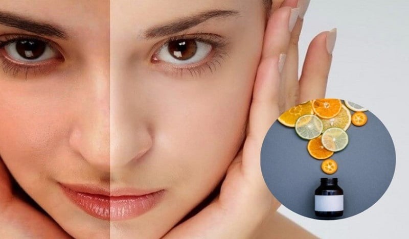 Để đạt hiệu quả tối ưu, việc kết hợp vitamin C vào buổi sáng với kem chống nắng là nguyên tắc bắt buộc.