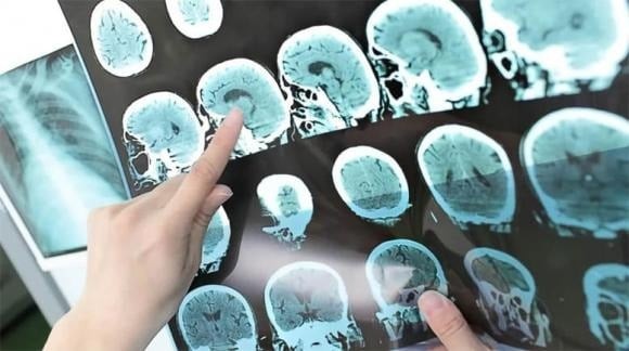 Nếu xuất hiện bất kỳ dấu hiệu nào trên, cần đi khám ngay để được chẩn đoán và điều trị kịp thời, tránh biến chứng nguy hiểm.


