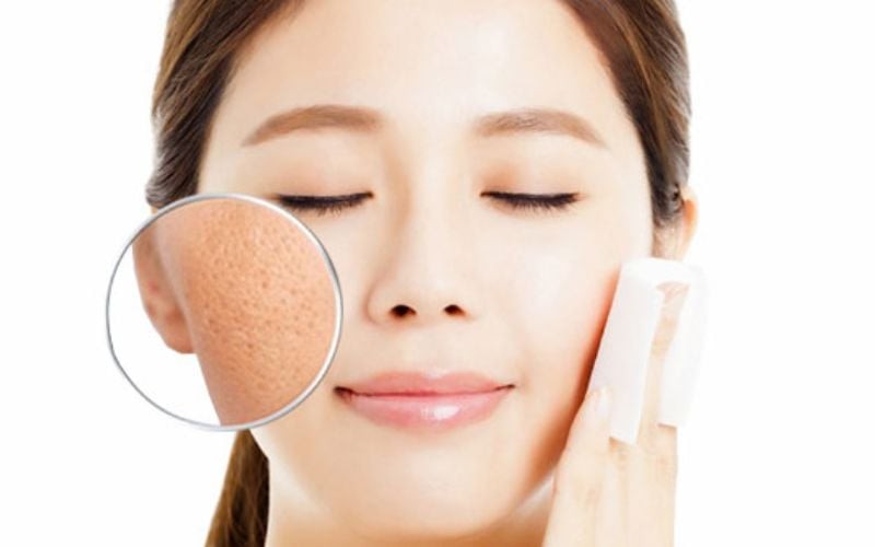 Một loại kem dưỡng chứa hyaluronic acid, peptide hoặc ceramide sẽ giúp cấp ẩm sâu