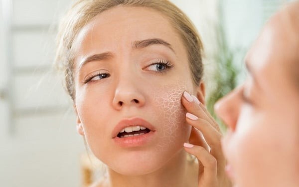 Một trong những nguyên nhân phổ biến nhất chính là sự thiếu ẩm.