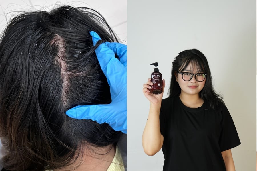Cẩm Nhiên tự tin với mái tóc sạch khỏe sau khi sử dụng Antisol