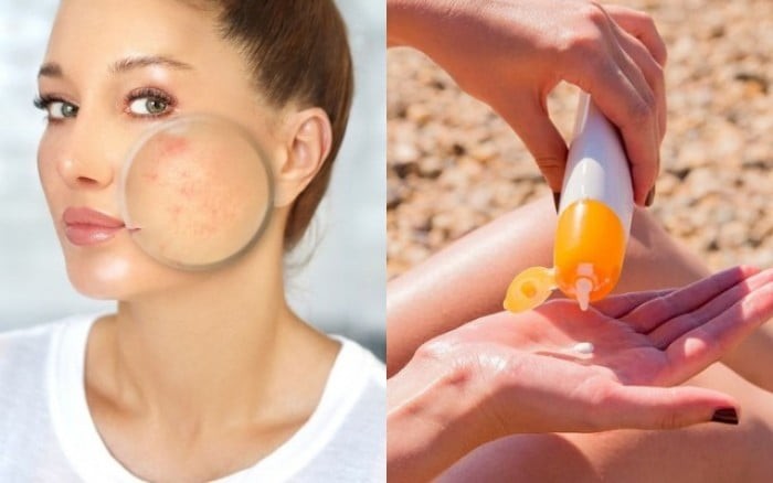 Cả hai đều có khả năng bảo vệ da khỏi tia UV, nhưng cách hoạt động khác nhau