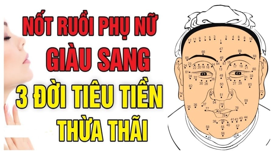 Nốt ruồi may mắn