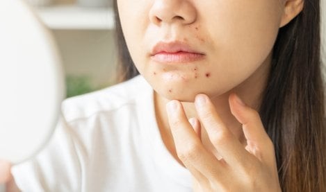 Trong những trường hợp cần cấp tốc, nước đá chính là “trợ thủ” hiệu quả. 