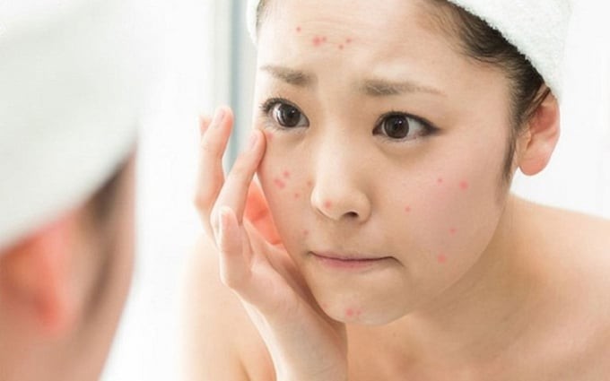 Khi bước sang ngưỡng tuổi 30, làn da bắt đầu thay đổi rõ rệt dưới tác động của quá trình lão hóa.