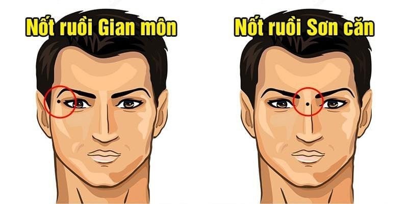 Nốt ruồi phá tướng nên hóa giải