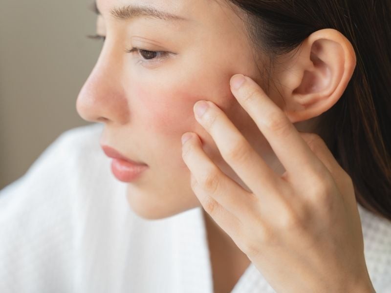Việc ở lâu trong môi trường điều hòa còn khiến da mất nước nhanh hơn